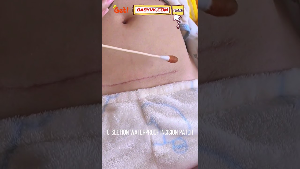C-Section Waterproof Incision Patch: Protect Your Healing Scar in Every Shower #MomTips #CSection