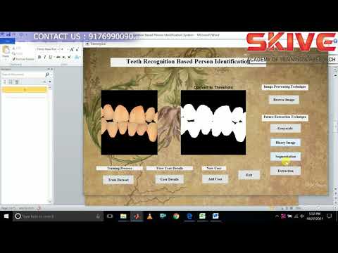 Teeth Recognition for Person Identification using MATLAB | IEEE 2021 - Image Processing Project