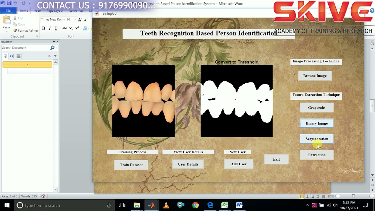 Teeth Recognition for Accurate Person Identification Using MATLAB | IEEE 2021 Image Processing Project
