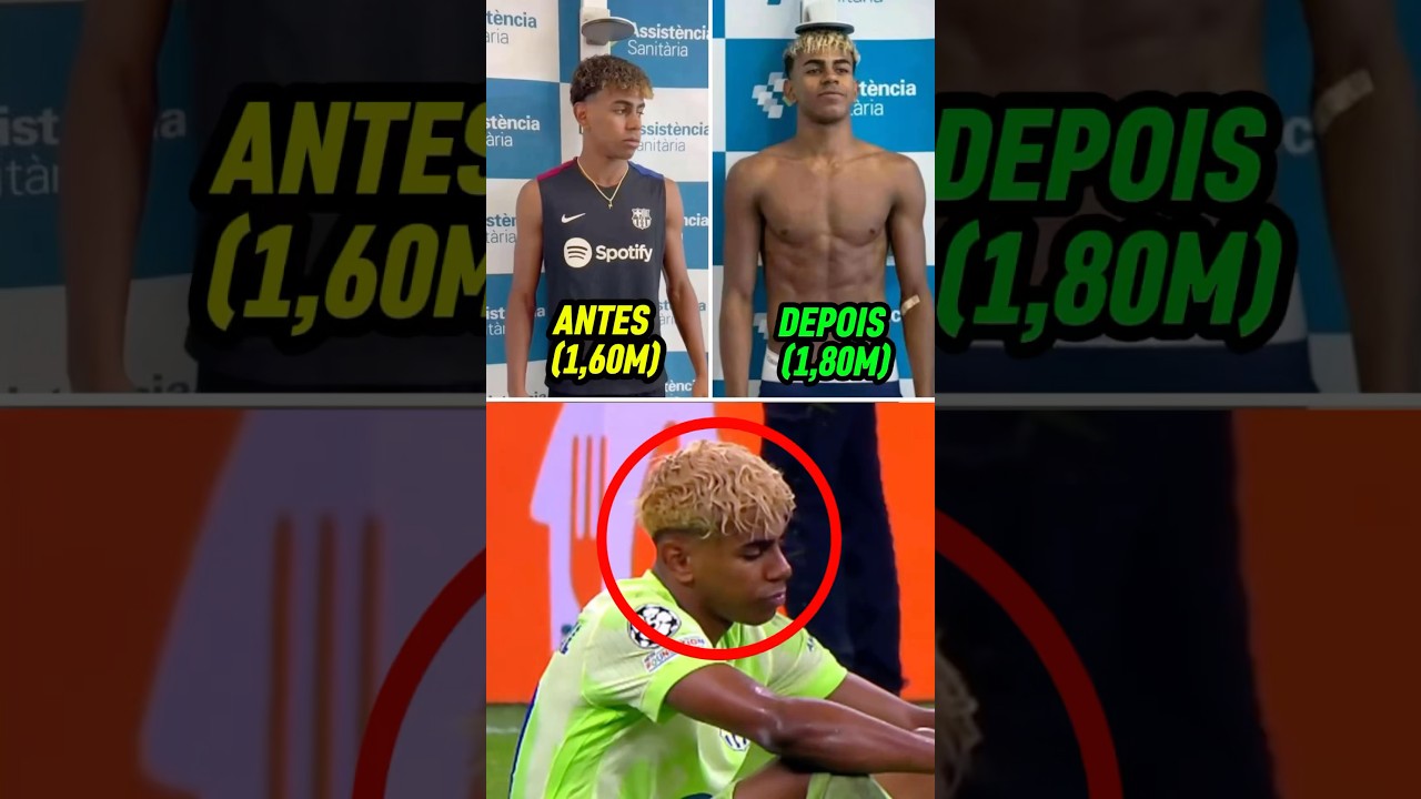 Yamal Não Pode Mais Jogar Futebol ⚽