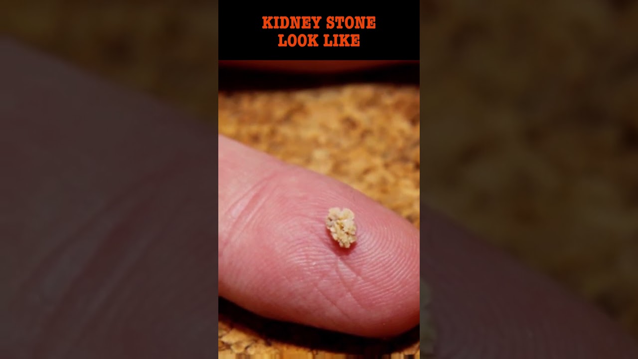 StoneFree AI: Your Support in Tough Times 🪨