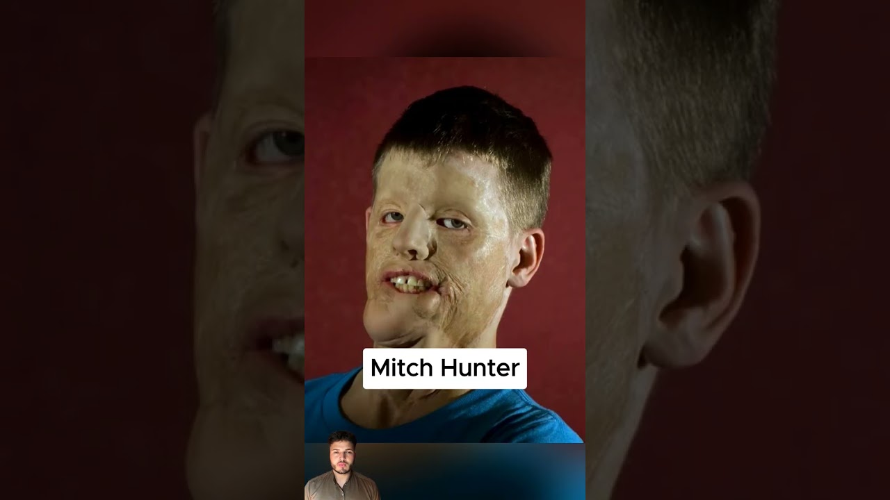 Soldiers Before & After War 😮