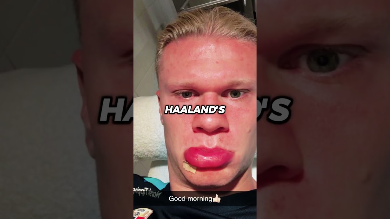 Hansi Flick Reveals Yamal Played Injured in Spain