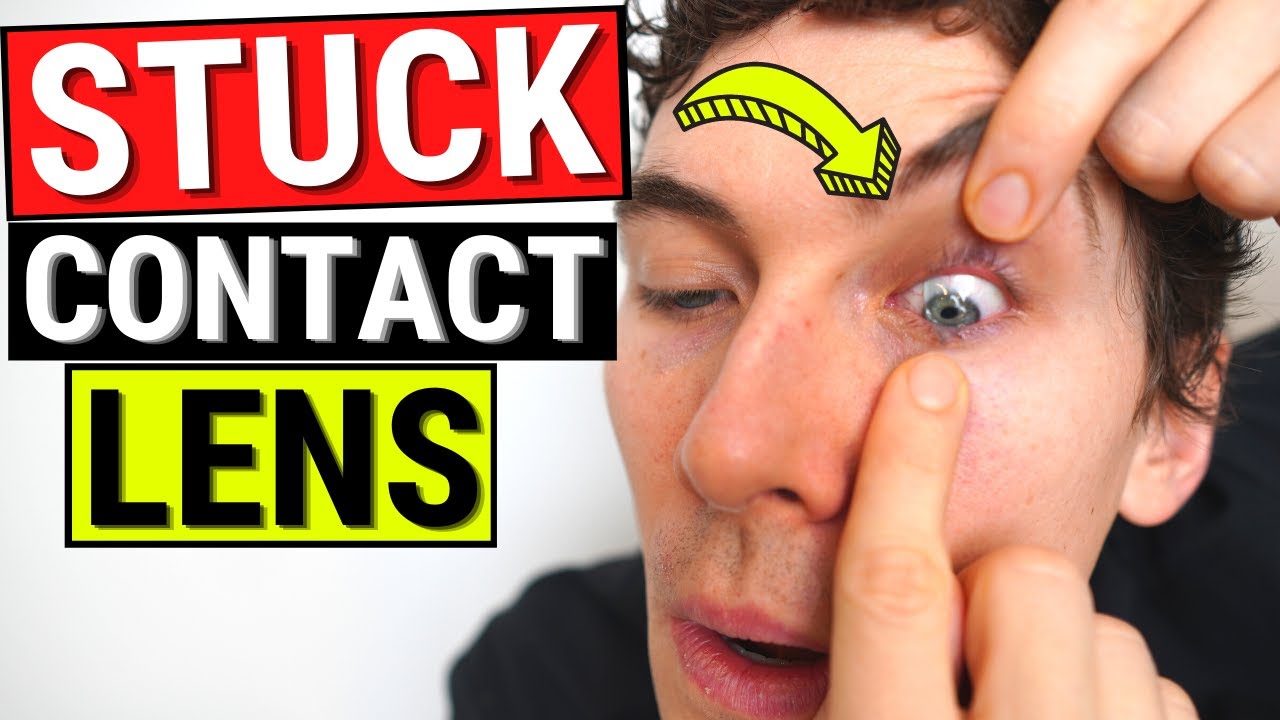 How to Remove a Stuck Contact Lens 👁️
