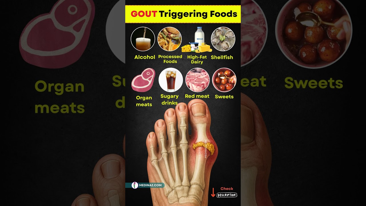 🚫 Top 10 Foods That Trigger Gout Attacks and How to Prevent Pain