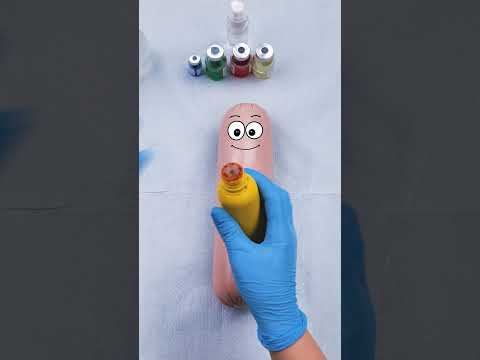 Emergency C section, sausage gives birth to a nugget!