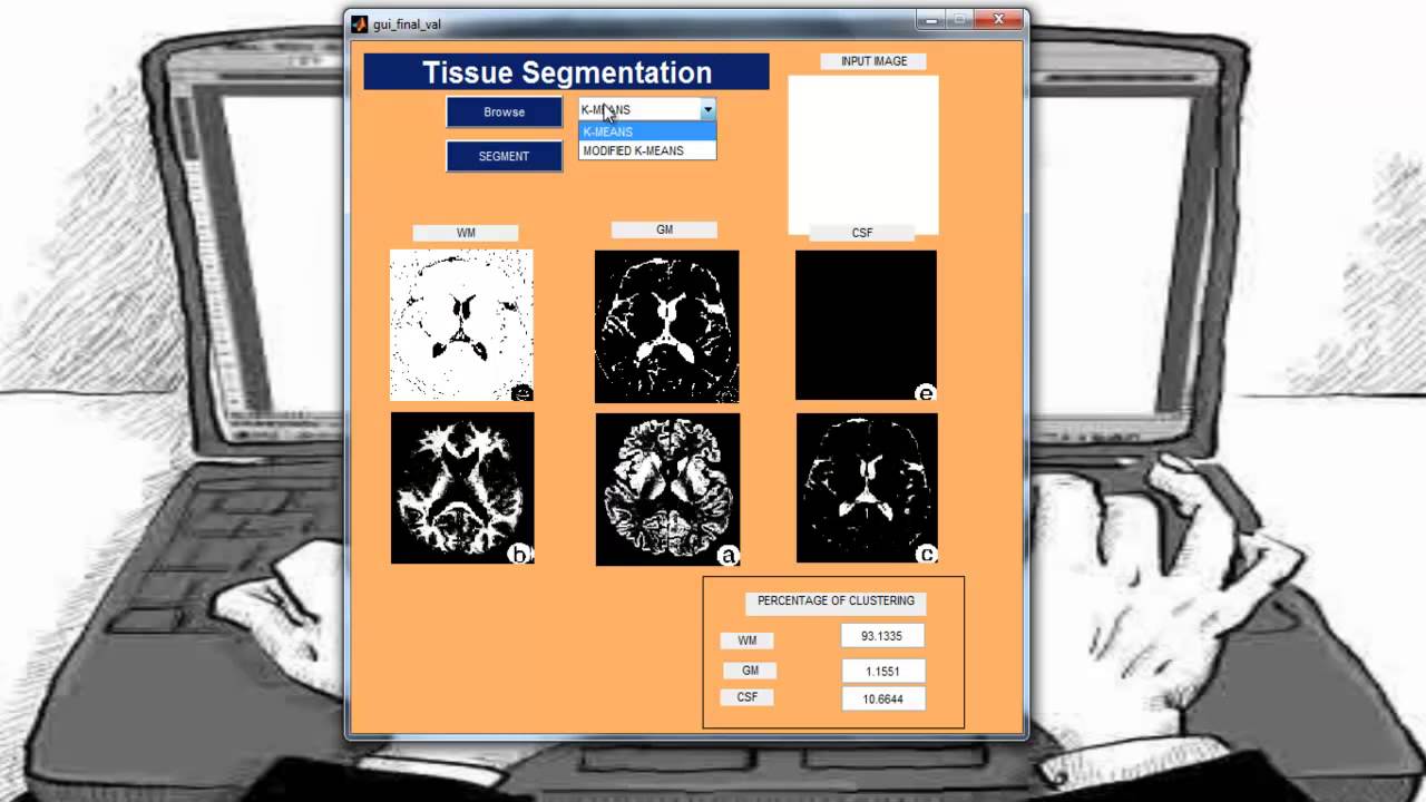 Matlab Thesis Topics & Academic Projects π