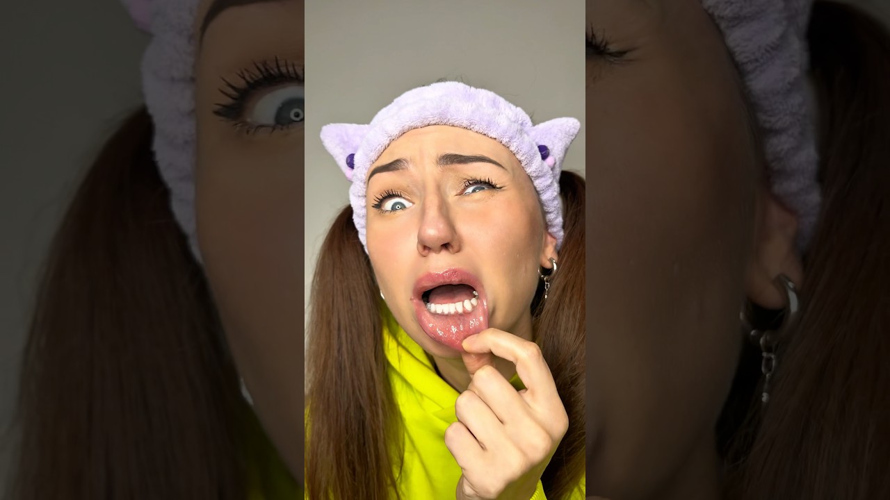 Когда случайно прикусил губу — смешные моменты из жизни 😂
