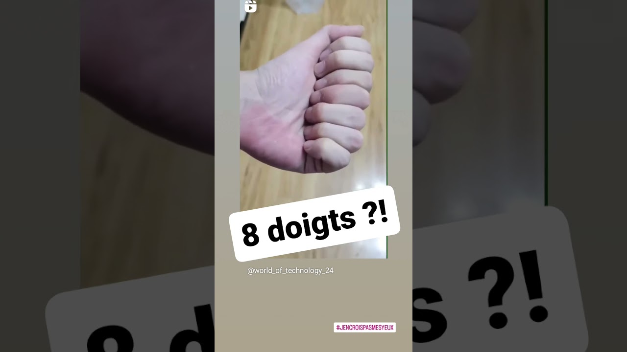 Incroyable ! Une main avec 8 doigts qui défie la logique 🖐️