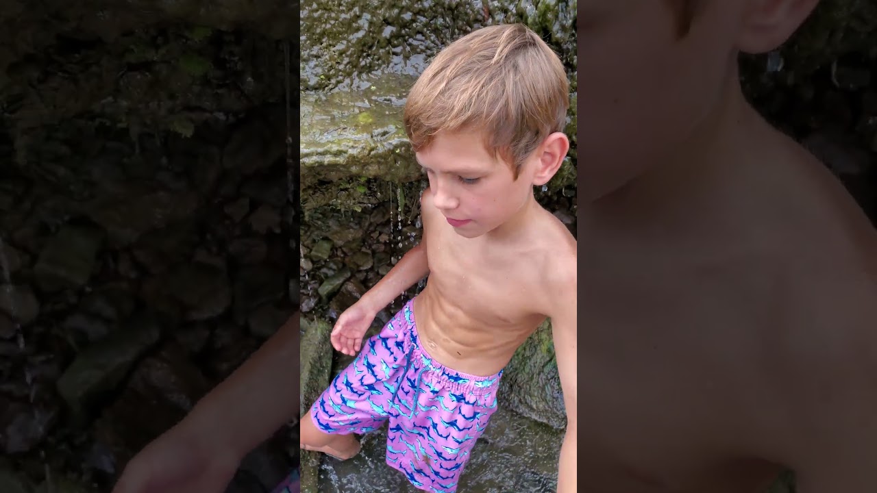 Severe Rock Cut Injury: My Abs Took the Hit 💥