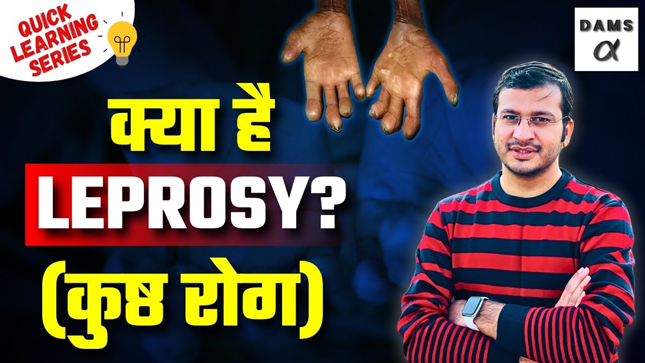 Leprosy Explained: Complete Guide by Siddharth Sir 🩺