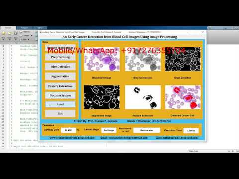 An Early Cancer Detection from Blood Cell Images | Matlab Source Code