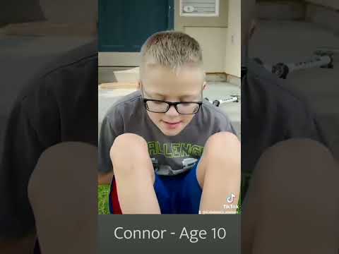 الفرق بين الطفل العادي وطفل التوحد #عبدالعزيز_شعلان