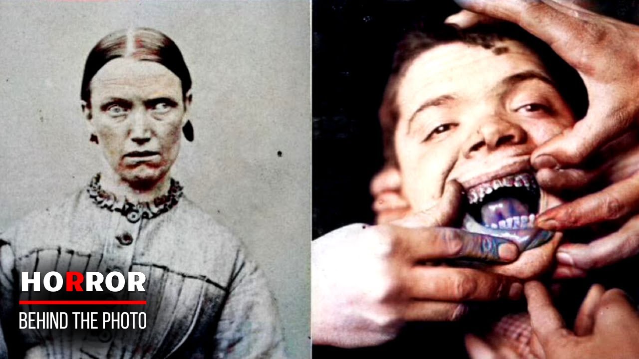 Dark Secrets of Bedlam Mental Asylum 🏥