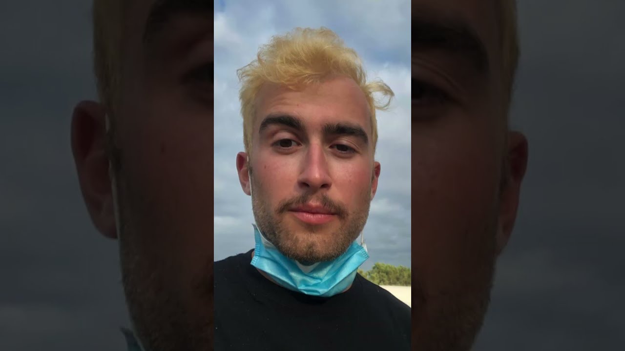 The Journey Of Going Bald (in 567.5 Days)