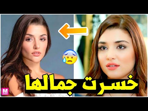 الحسناء هاندا أرتشيل تصدم جمهورها بتغير ملامحها بالكامل بسبب الانتقادات