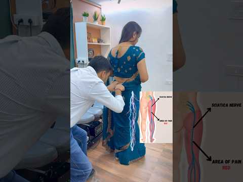 Sciatica pain treatment in India by dr harish grover #trend #ytshort #feed #shortfeed