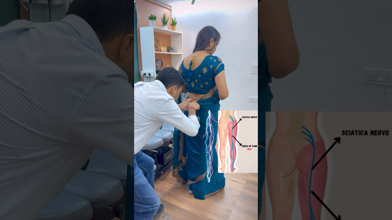Sciatica Pain Treatment in India by Dr. Harish Grover ๐ฎ๐ณ