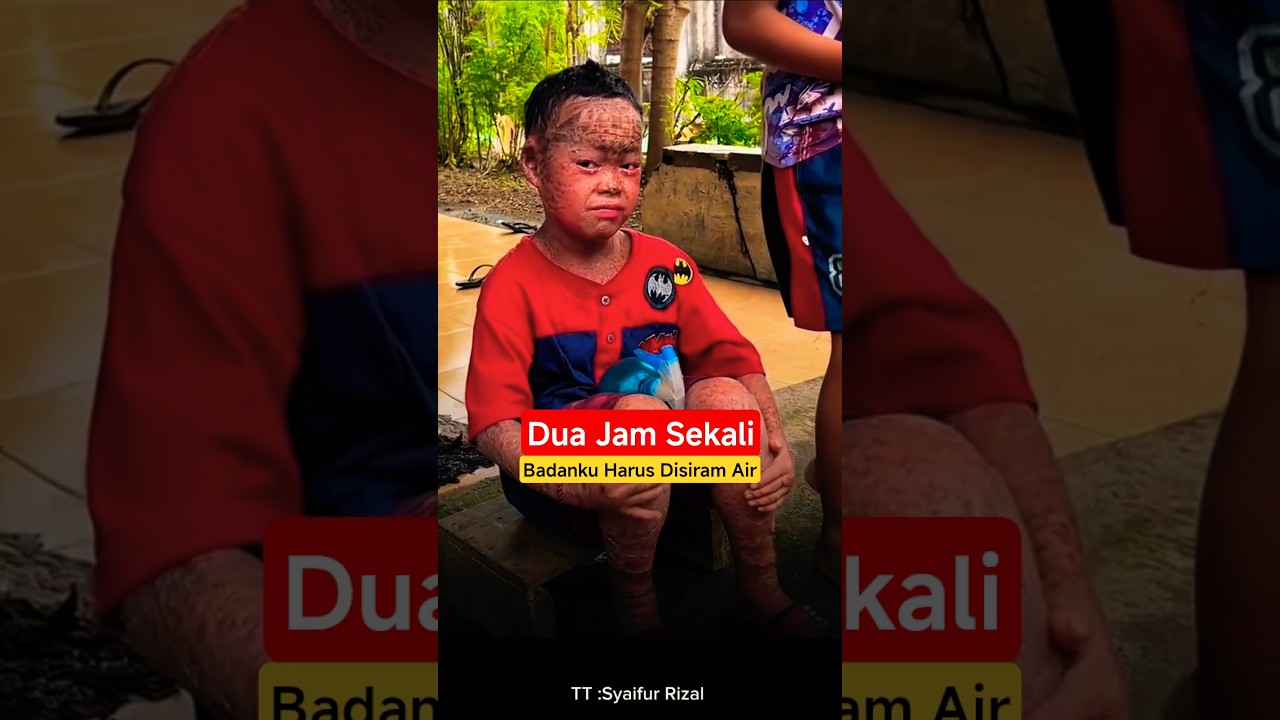 2 Dek Okta Disiram Air Setiap 2 Jam, Kisah Mengharukan 😢