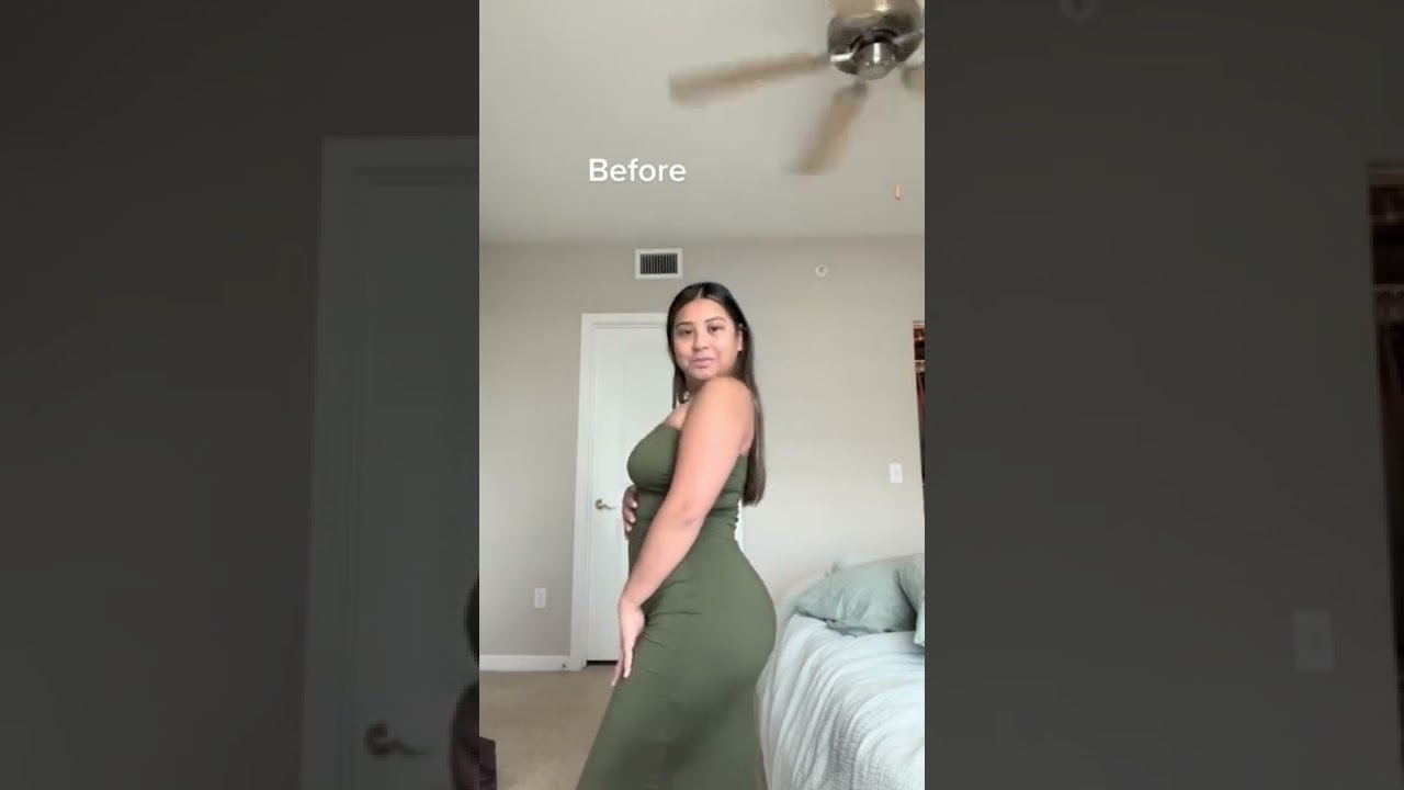 Before & After BBL Results by Dr. William