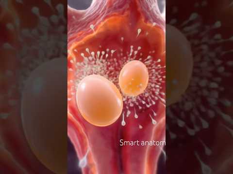 Fraternal Twins If both eggs get fertilized by 2 different sperm cells, fraternal (dizygotic) twins