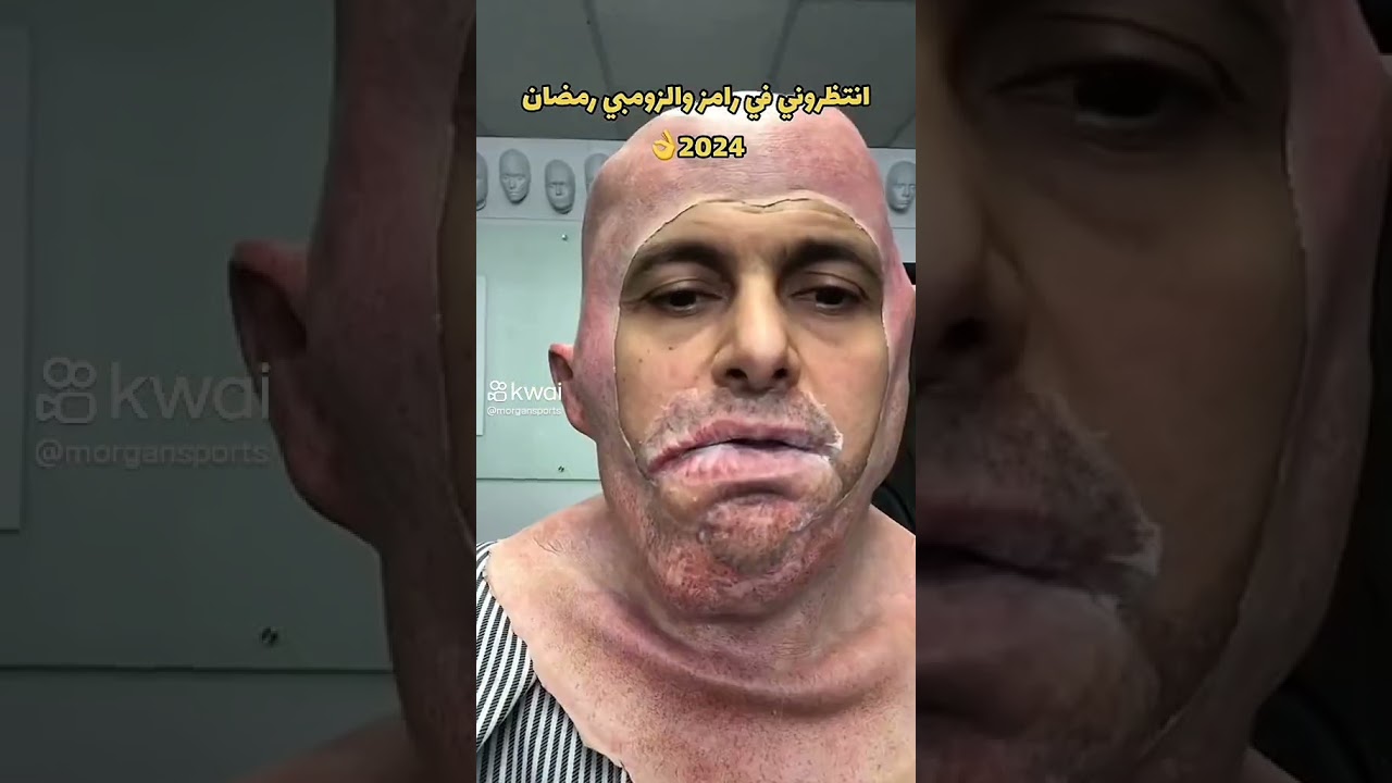 رامز الزومبي في رمضان 2024 🧟♂️.. هل يحقق أعلى نسب مشاهدة؟