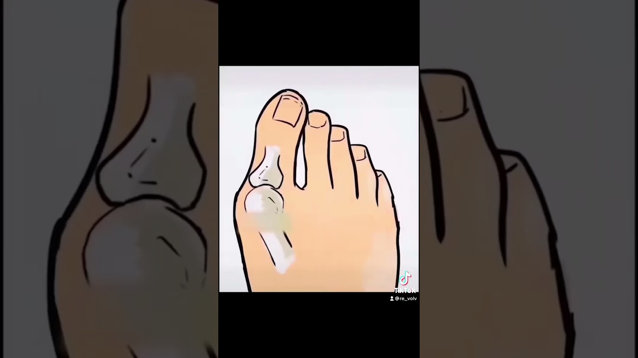 Fix Your Narrow Feet 👣