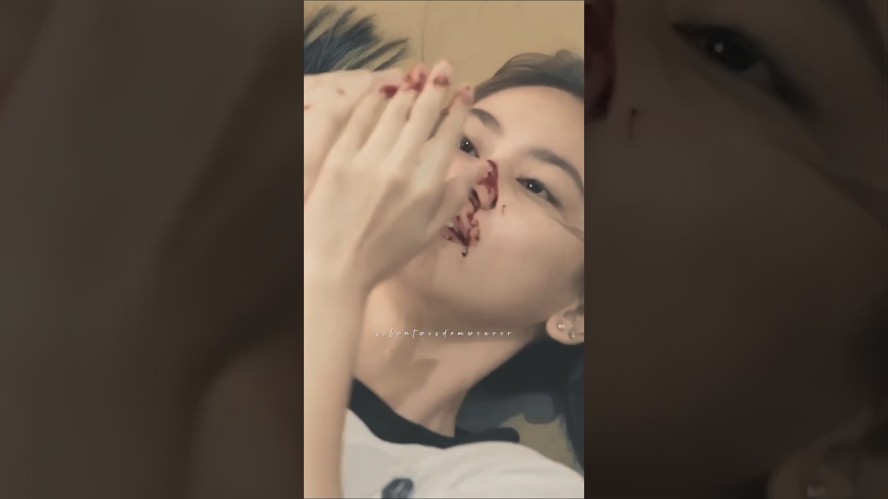 Jay-jay Shocked by Blood 😢