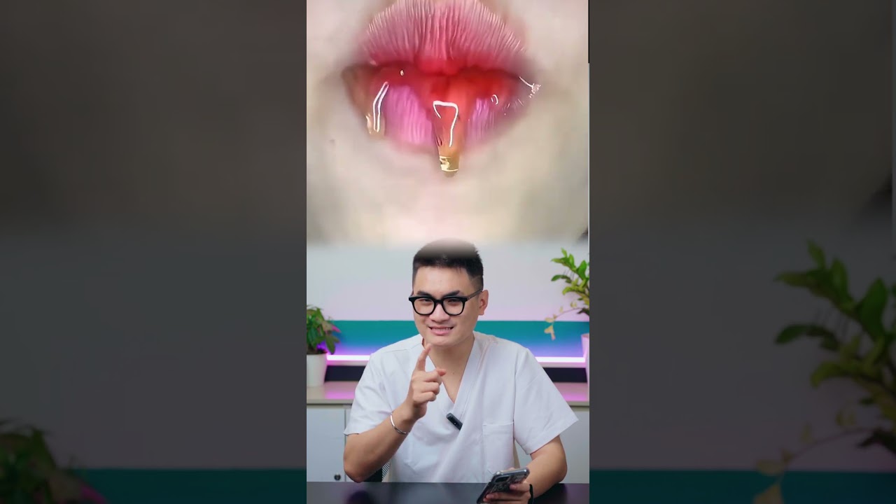 Niềng Răng Ăn Gì? EP3 | Nha Khoa Vidental 🦷