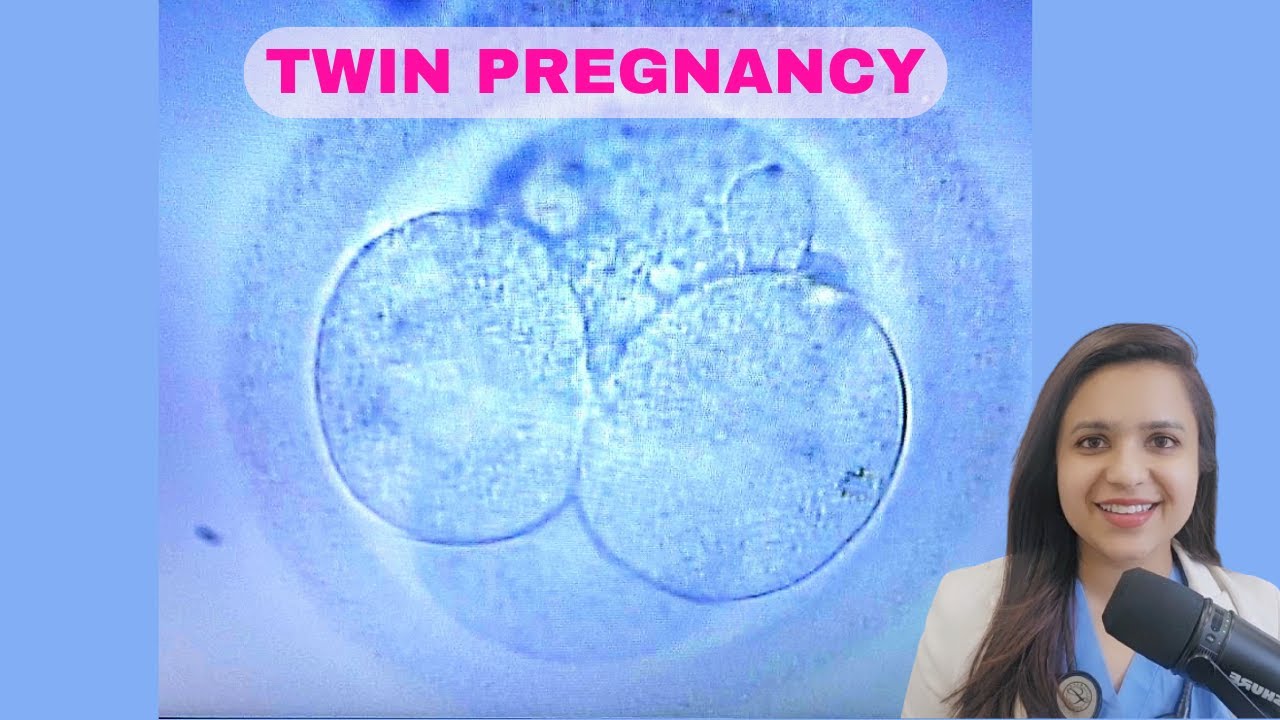 Expert Tips for Conceiving Twins