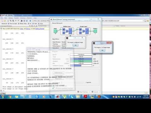 Breast cancer detection using matlab|M tech project consultancies in Bangalore