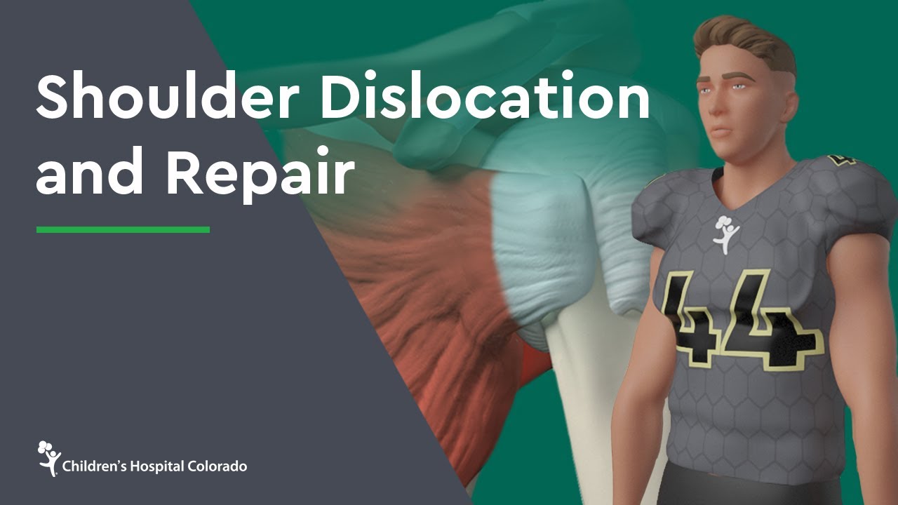 Shoulder Dislocation & Repair 🩺