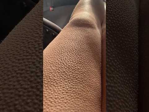 Agar Aapke Body Mein Aise Dot Dot Dikhane Lage |😲😲| #shorts