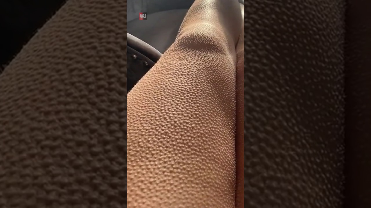 Agar Aapke Body Mein Aise Dot Dot Dikhane Lage |😲😲| #shorts