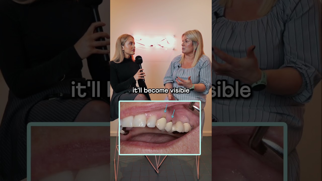 Dental Bridge Lifespan: How Long Does It Last? 🦷