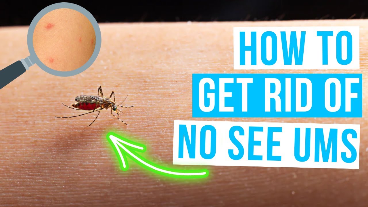 Effective Tips to Eliminate No-See-Ums ๐ฆ