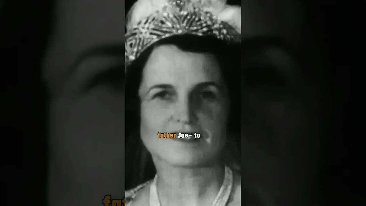 Rosemary Kennedy's Lobotomy: A Controversial History