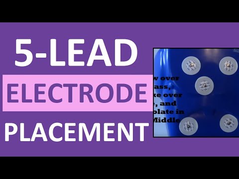 5 Lead Electrode Placement Cardiac Telemetry Monitor for EKG/ECG