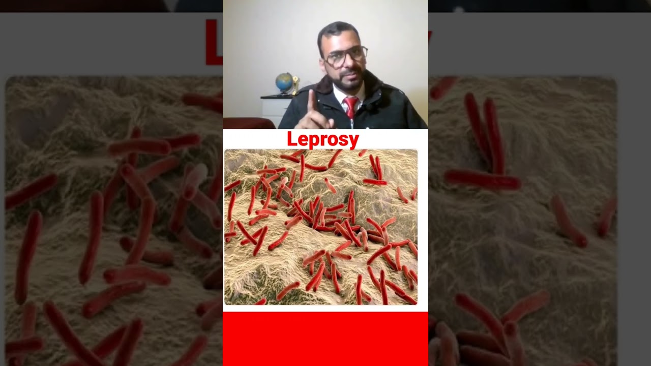 Leprosy: Full Video Insight