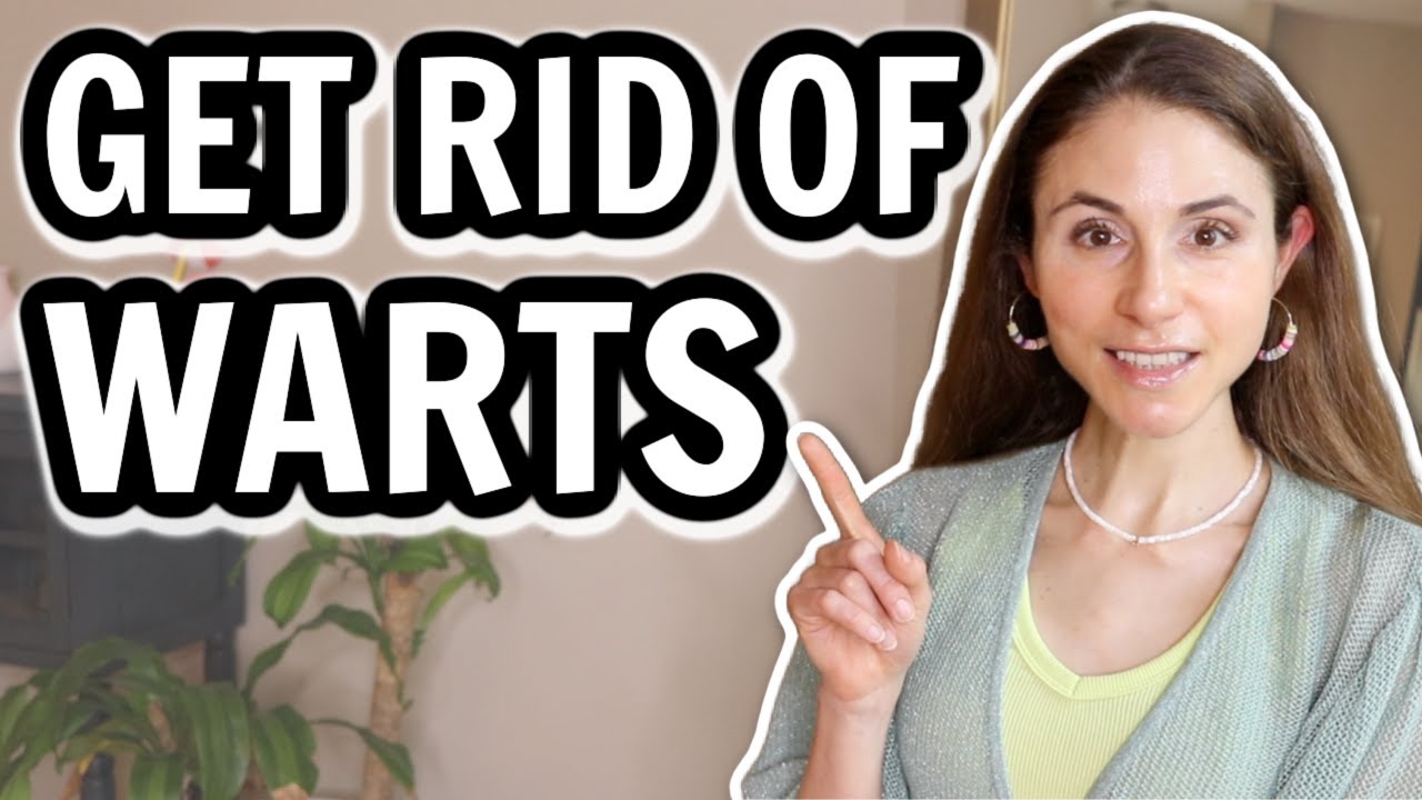 Effective Wart Removal Tips from DrDrayzday 👣