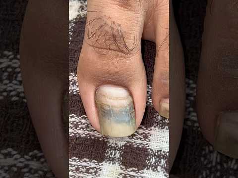 🙃 ASMR | nail day #asmr #asmrvideos #satisfying #relax #relaxing #tingles #sleep #oddlysatisfying