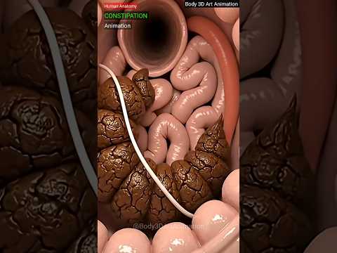 Constipation Explained in 3D Animation | Human Anatomy Digestive System | Health Education Video