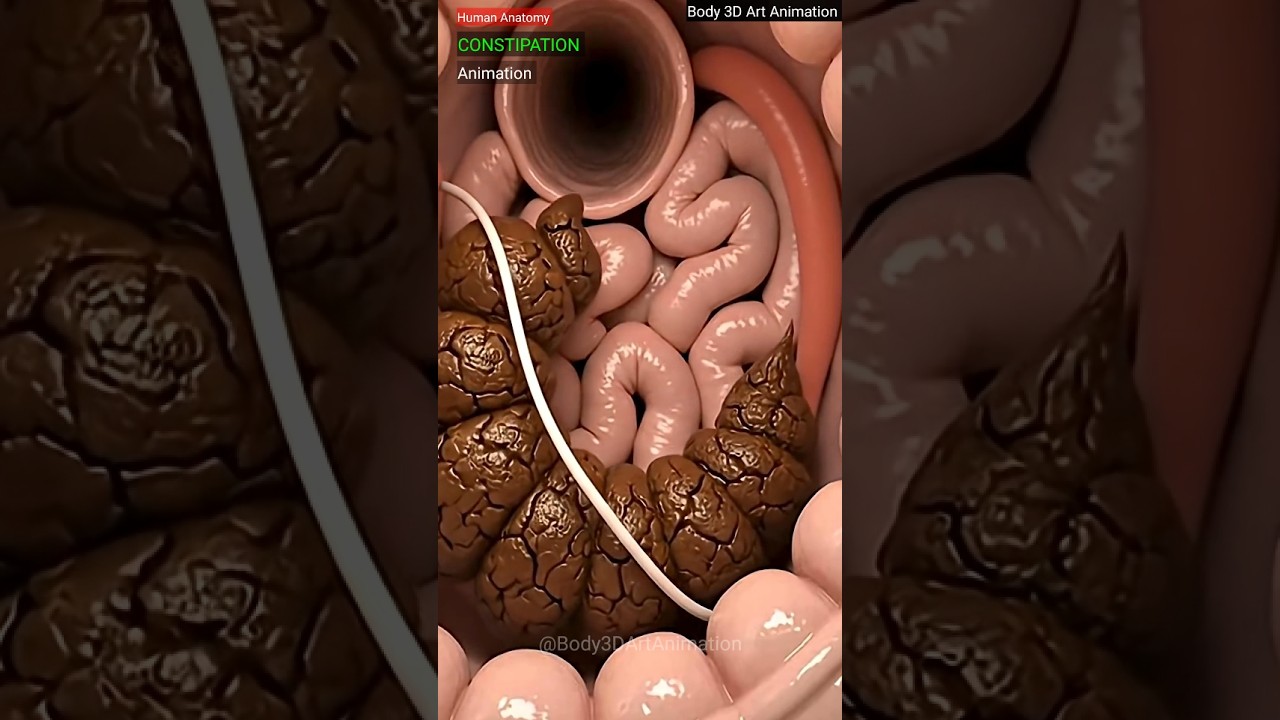 3D Animation Explains Constipation 🩺