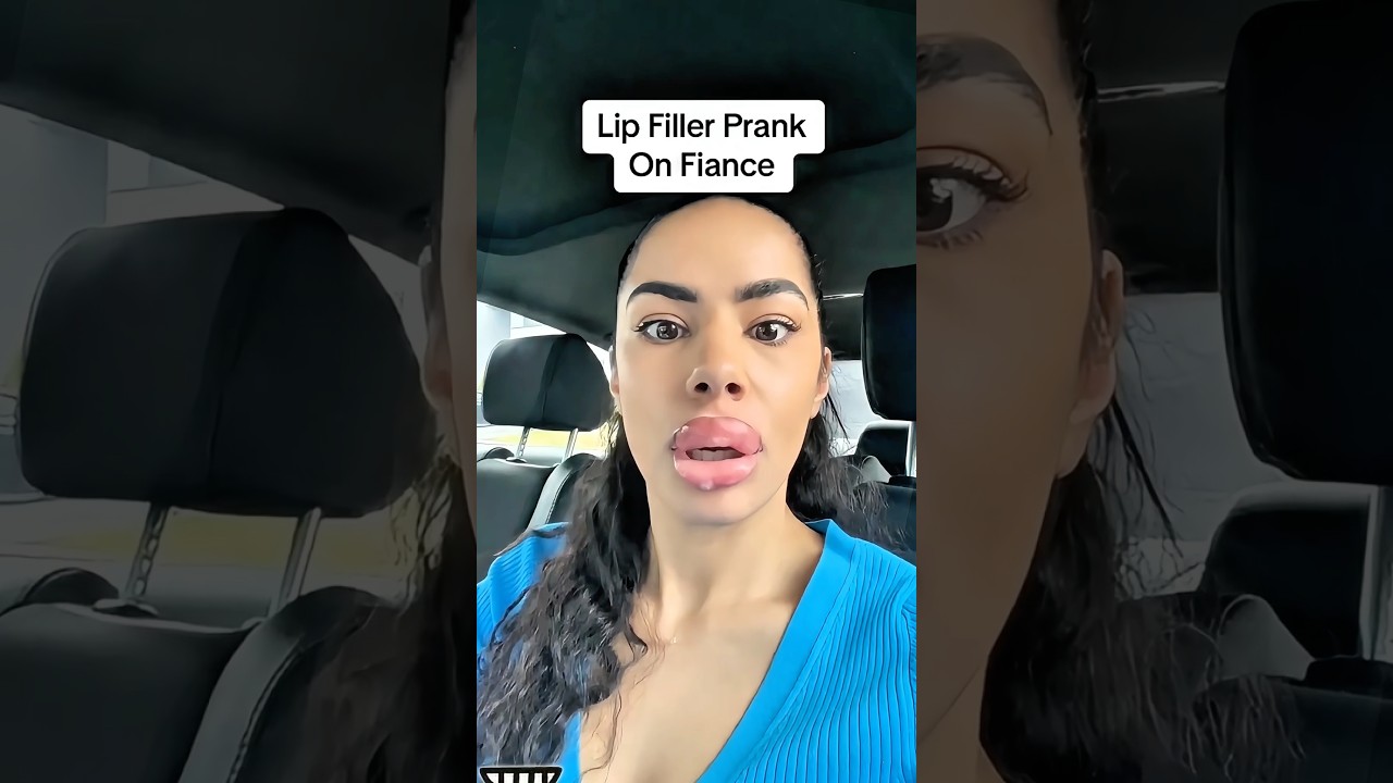 Lip Filler Prank on Fiancé