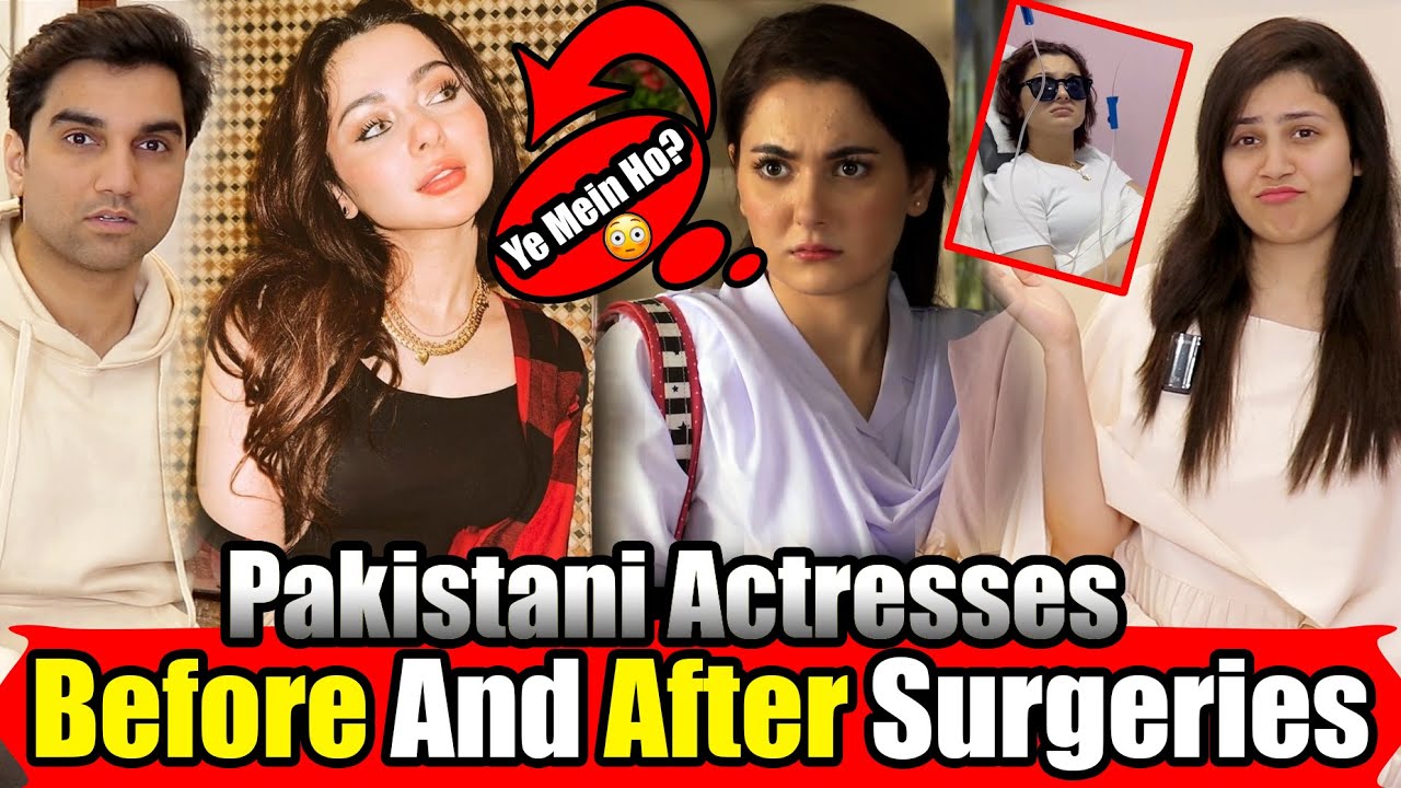 Pakistani Actresses' Stunning Post-Surgery Makeovers ✨