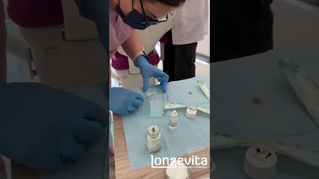 Dental Crown Cementation for Lasting Hold 🦷