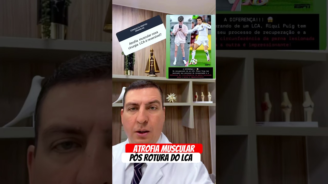 Atrofia muscular: Pós rotura do LCA!