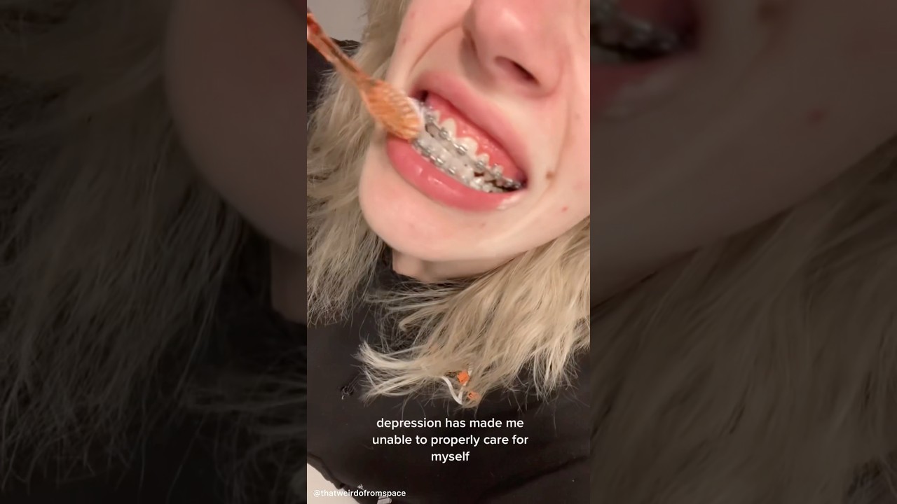 That’s Gross 🤢