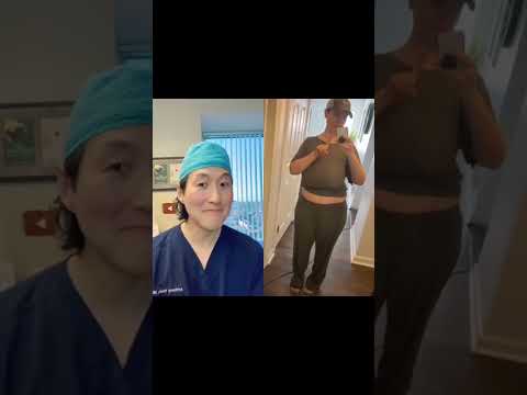 My Patient’s Breast Reduction Journey! #shorts #breastreduction
