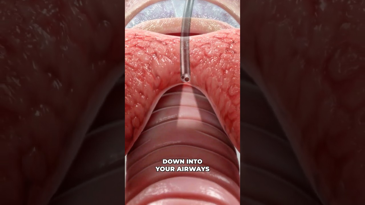 Bronchoscopy 3D Animation: Lung Exam Procedure